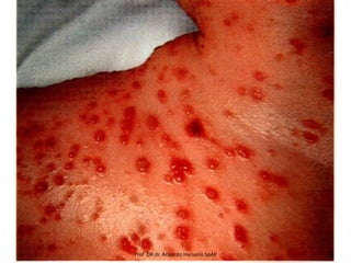 Prof DR.dr. Ariyanto Harsono SpAK

 