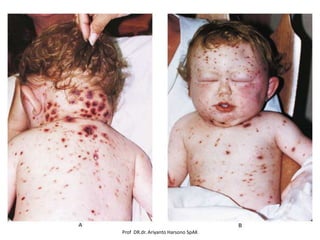 Prof DR.dr. Ariyanto Harsono SpAK

 