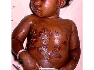 Prof DR.dr. Ariyanto Harsono SpAK

 