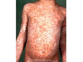 Prof DR.dr. Ariyanto Harsono SpAK

 