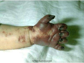 Prof DR.dr. Ariyanto Harsono SpAK

 