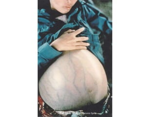 Prof DR.dr. Ariyanto Harsono SpAK

 