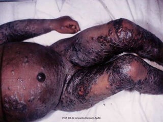 Prof DR.dr. Ariyanto Harsono SpAK

 