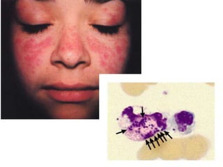 Prof DR.dr. Ariyanto Harsono SpAK

 