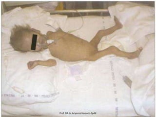 Prof DR.dr. Ariyanto Harsono SpAK

 