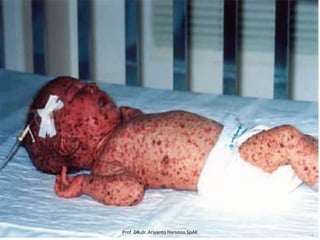 Prof DR.dr. Ariyanto Harsono SpAK

 