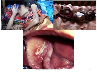 Prof Ariyanto Harsono MD PhD SpA(K)

52

 