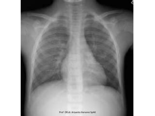 Prof DR.dr. Ariyanto Harsono SpAK

 