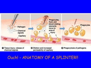 Ouch! - ANATOMY OF A SPLINTER!!
 