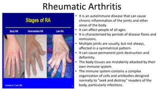 Immune system | PPTX