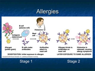 AllergiesAllergies
Stage 1 Stage 2
 