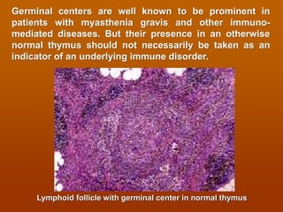 Lymphoid system and immune system histology view | PDF