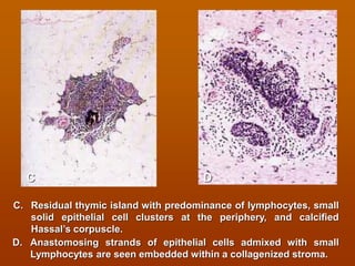Lymphoid system and immune system histology view | PDF