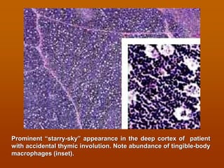 Lymphoid system and immune system histology view | PDF