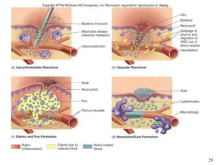 Insert figure 14.13
 Events in inflammation




                          29
 