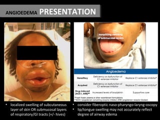 ANGIOEDEMA PRESENTATION
• consider fiberoptic naso-pharyngo-laryng-oscopy
• lip/tongue swelling may not accurately reflect...