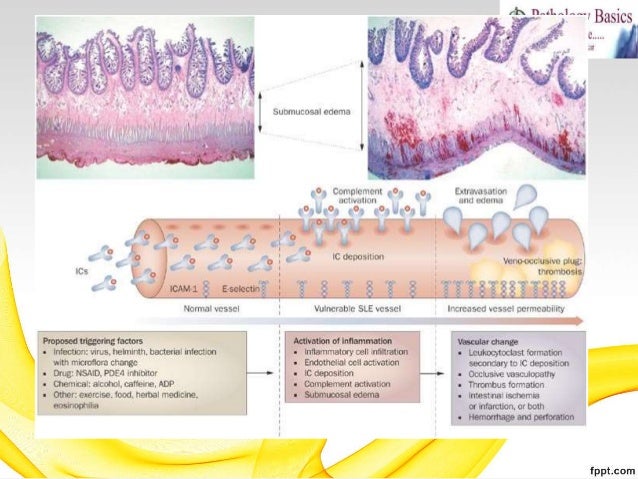 Immunity - concepts - antigen, antibody, ag-ab reactions ...