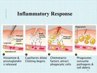 Inflammatory Response
Histamine &
prostaglandin
s released
Capillaries dilate
Clotting begins
Chemotactic
factors attract
phagocytic cells
Phagocytes
consume
pathogens &
cell debris
16
 