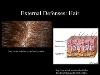 External Defenses: Hair 
http://www.hairdirect.com/hair/systems/s 
kin/hd10.aspx 
http://www.hmh.net/adamhealth/In- 
Depth%20Reports/10/000032.htm 
 