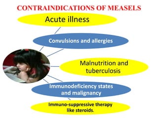 CONTRAINDICATIONS OF MEASELS
Acute illness
Convulsions and allergies
Malnutrition and
tuberculosis.
Immunodeficiency states
and malignancy
Immuno-suppressive therapy
like steroids.
 