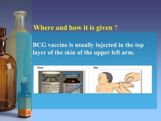 Where and how it is given ?
BCG vaccine is usually injected in the top
layer of the skin of the upper left arm.
 