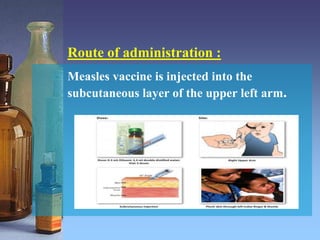 Measles vaccine is injected into the
subcutaneous layer of the upper left arm.
Route of administration :
 