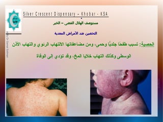 10/09/12
17
PreparedByDrGamalSoliman
S ilv e r C r e s c e n t D is p e n s a r y – K h o b a r - K S A
–‫الخبر‬ ‫الفضى‬ ‫الهلل‬ ‫مستوصف‬–‫الخبر‬ ‫الفضى‬ ‫الهلل‬ ‫مستوصف‬
‫المعدية‬ ‫المراض‬ ‫ضد‬ ‫التحصين‬‫المعدية‬ ‫المراض‬ ‫ضد‬ ‫التحصين‬
.
‫الحصبة‬‫النذن‬ ‫والتهاب‬ ‫الرئوي‬ ‫اللتهاب‬ ‫مضاعفاتها‬ ‫ومن‬ ،‫وحمى‬ ‫ًيا‬ّ‫جلد ا‬ ‫حا‬ً‫ا‬ ‫طف‬ ‫تسبب‬ :
‫الوفاة‬ ‫إلى‬ ‫تؤدي‬ ‫وقد‬ ،‫المخ‬ ‫خلًيا‬ ‫التهاب‬ ‫وكذلك‬ ‫الوسطى‬
 