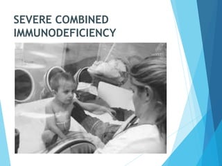 SEVERE COMBINED
IMMUNODEFICIENCY
 
