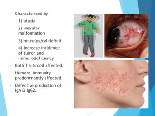 • Characterized by
1) ataxia
2) vascular
malformation
3) neurological deficit
4) increase incidence
of tumor and
immunodeficiency
• Both T & B cell affected.
• Humoral immunity
predominantly affected.
• Defective production of
IgA & IgG2.
 