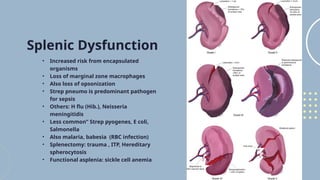 Strep Encapsulated adaptive immunity and lymph nodes and spleen are here | PPTX