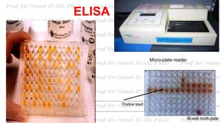 ELISA
8
Micro-plate reader
96-well micro-plate
Positive result
 