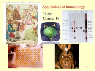 1
Applications of Immunology
Talaro
Chapter 16
 