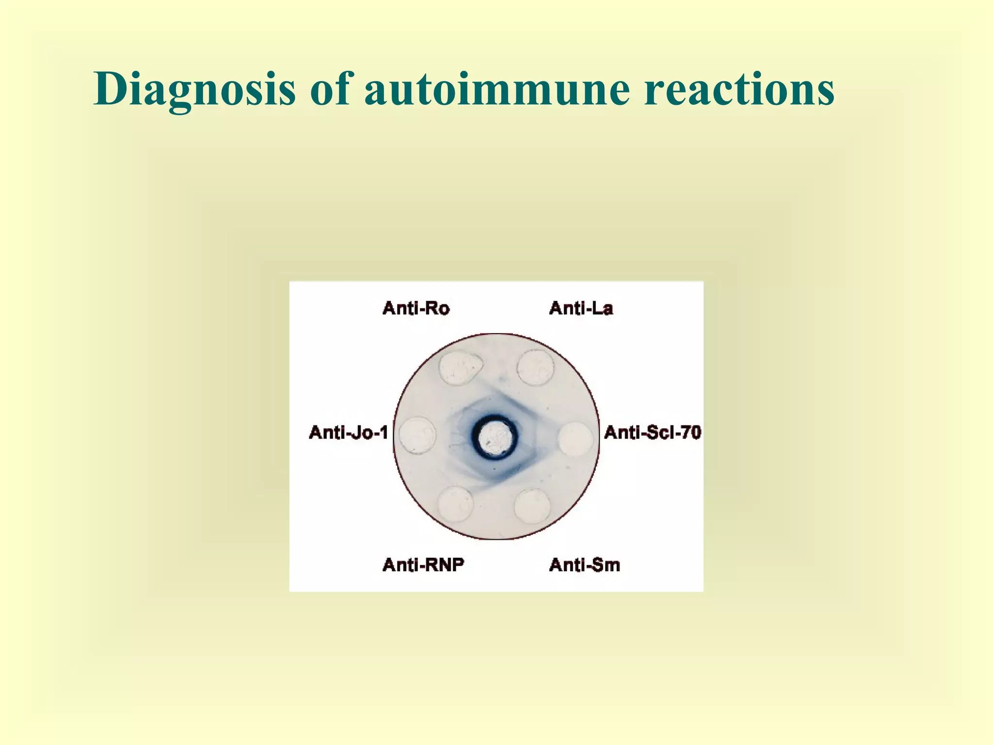 Immunodiagnosis | PPT