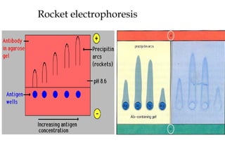 Rocket electrophoresis
 
