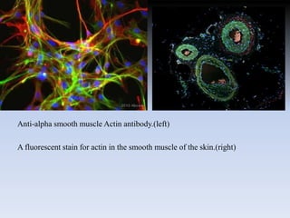 Anti-alpha smooth muscle Actin antibody.(left)
A fluorescent stain for actin in the smooth muscle of the skin.(right)
 