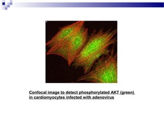 Confocal image to detect phosphorylated AKT (green)
in cardiomyocytes infected with adenovirus
 