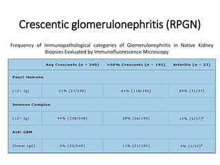 Crescentic Rpgn Immunofluorescence and its role in histopathology | PPTX