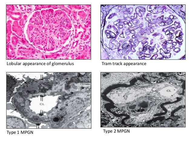 immunofluorescence and its role in histopathology 33 638