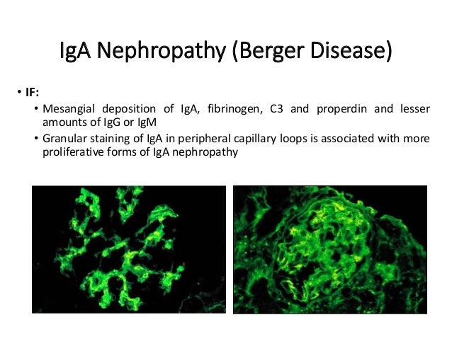 immunofluorescence and its role in histopathology 37 638