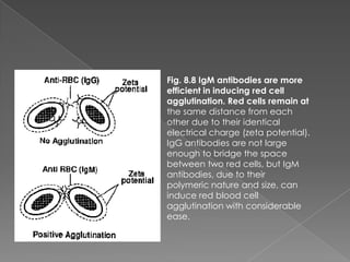 Fig. 8.8 IgM antibodies are more
efficient in inducing red cell
agglutination. Red cells remain at
the same distance from each
other due to their identical
electrical charge (zeta potential).
IgG antibodies are not large
enough to bridge the space
between two red cells, but IgM
antibodies, due to their
polymeric nature and size, can
induce red blood cell
agglutination with considerable
ease.
 