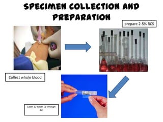 Specimen Collection and
              Preparation
                                      prepare 2-5% RCS




Collect whole blood




          Label 12 tubes (1 through
                     12)
 