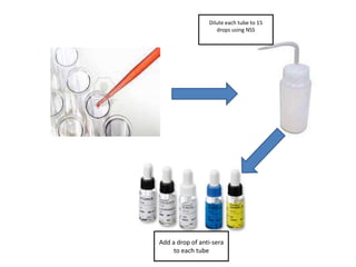 Dilute each tube to 15
                    drops using NSS




Add a drop of anti-sera
     to each tube
 