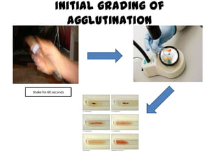 Initial grading of
                agglutination




Shake for 60 seconds
 