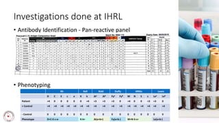 Investigations done at IHRL
• Antibody Identification - Pan-reactive panel
• Phenotyping
Rh Kell Kidd Duffy MNSs Lewis
D C E c e K k Jka Jkb Fya Fyb M N S s Lea Leb
Patient +4 0 0 0 0 0 +4 +3 +3 +3 0 +4 0 0 +3 +3 0
+ Control +4 +4 +4 +4 +4 +4 +4 +4 +4 +4 +4 +4 +4 +4 +4 +4 +4
- Control 0 0 0 0 0 0 0 0 0 0 0 0 0 0 0 0 0
Phenotype D+C-E-c-e- K-k+ Jk(a+b+) Fy(a+b-) M+N-S-s+ Le(a+b-)
 