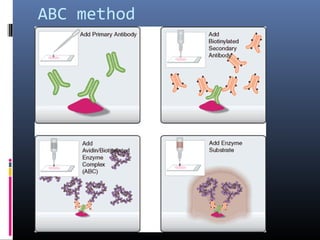 Using Abc Protocols Immunohistochemistry | PPT
