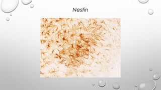 Nestin
 