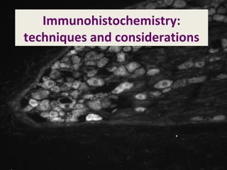 Immunohistochemistry:
techniques and considerations
 