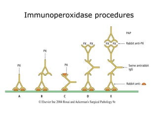 Immunoperoxidase procedures
• Put the two photographs from
Ackermann
 