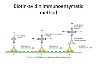 Biotin-avidin immunoenzymatic
method
 
