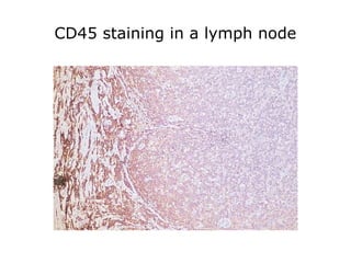 CD45 staining in a lymph node
 